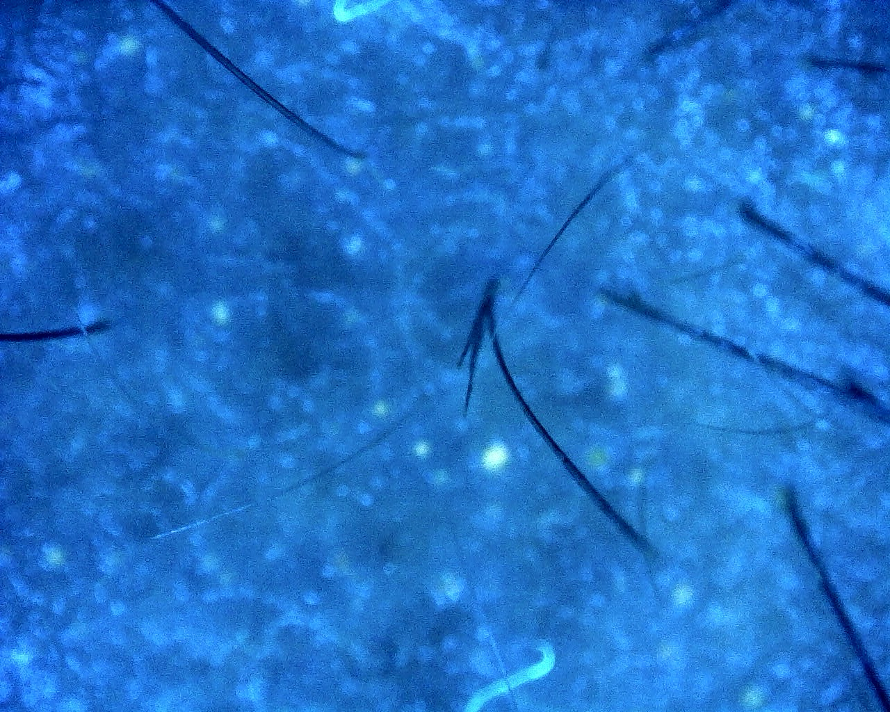 Trichoskopia UV